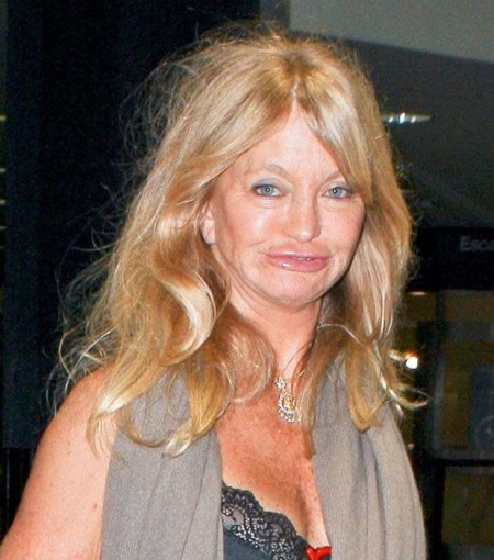Goldie-Hawn-plastic-surgery-disaster
