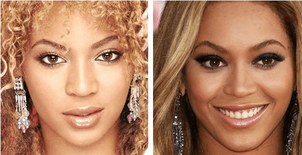 beyonce-nose-job-before-and-after-pictures