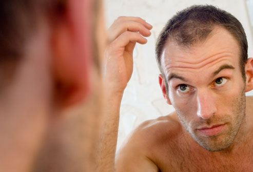 getty_rf_photo_of_balding_man_in_mirror